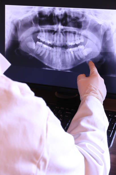 Best Emergency Dentist for Knocked-Out Tooth in Hoopa, CA