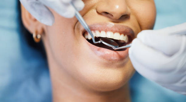 Best Emergency Cosmetic Dentistry in Hoopa, CA