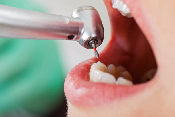 Best Emergency Dental Extractions in Hoopa, CA